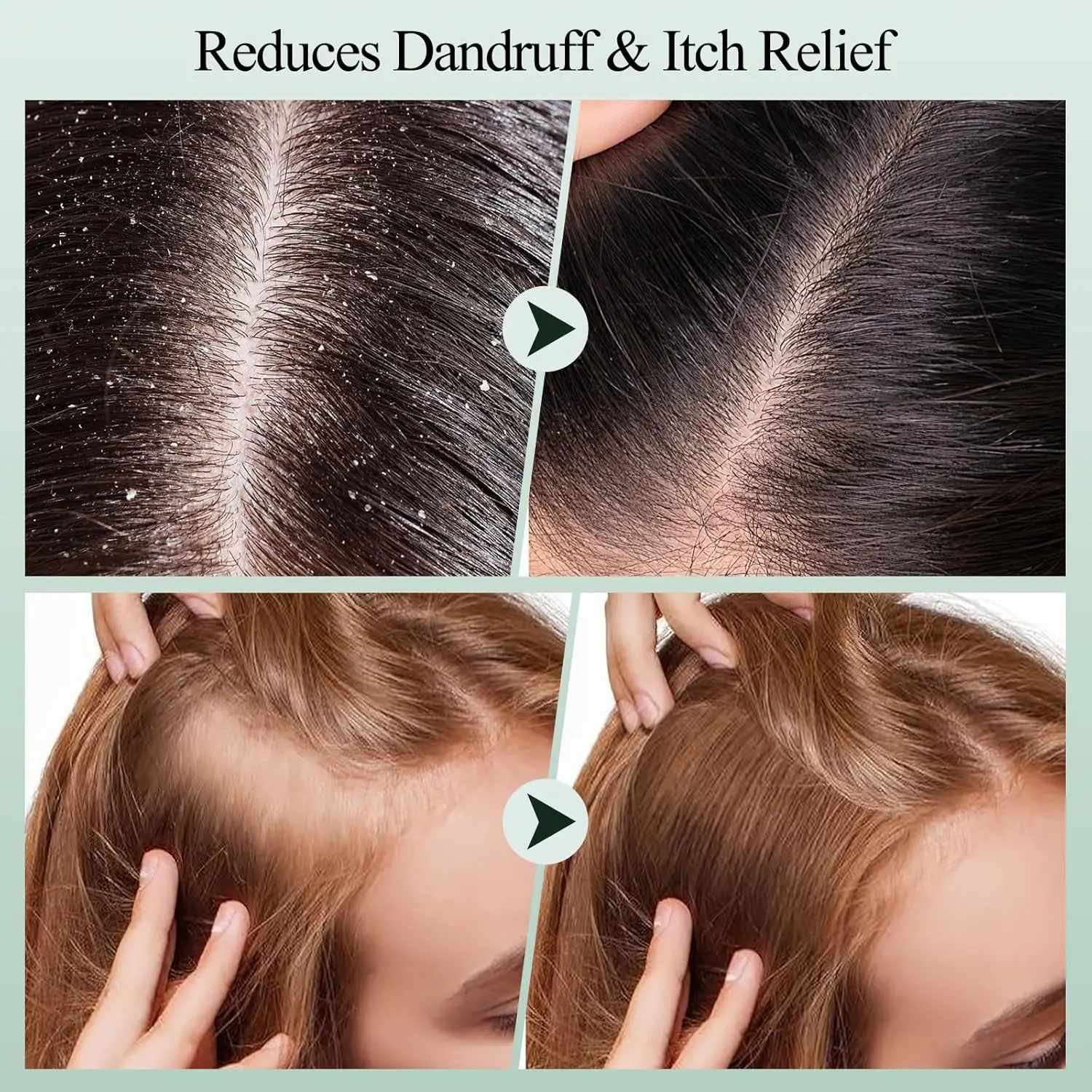 Rosemary Bio-Ferment Detox Shampoo Balm 72H Oil Control + Malassezia Defense Micro Carbon Spheres & Ceramide Infusion