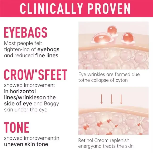 Instant Eye Bag Remove Cream Retinol Anti-Wrinkle Firming Skin Fade Fine Lines Anti Dark Circle Puffiness Brighten Eye SkinCare