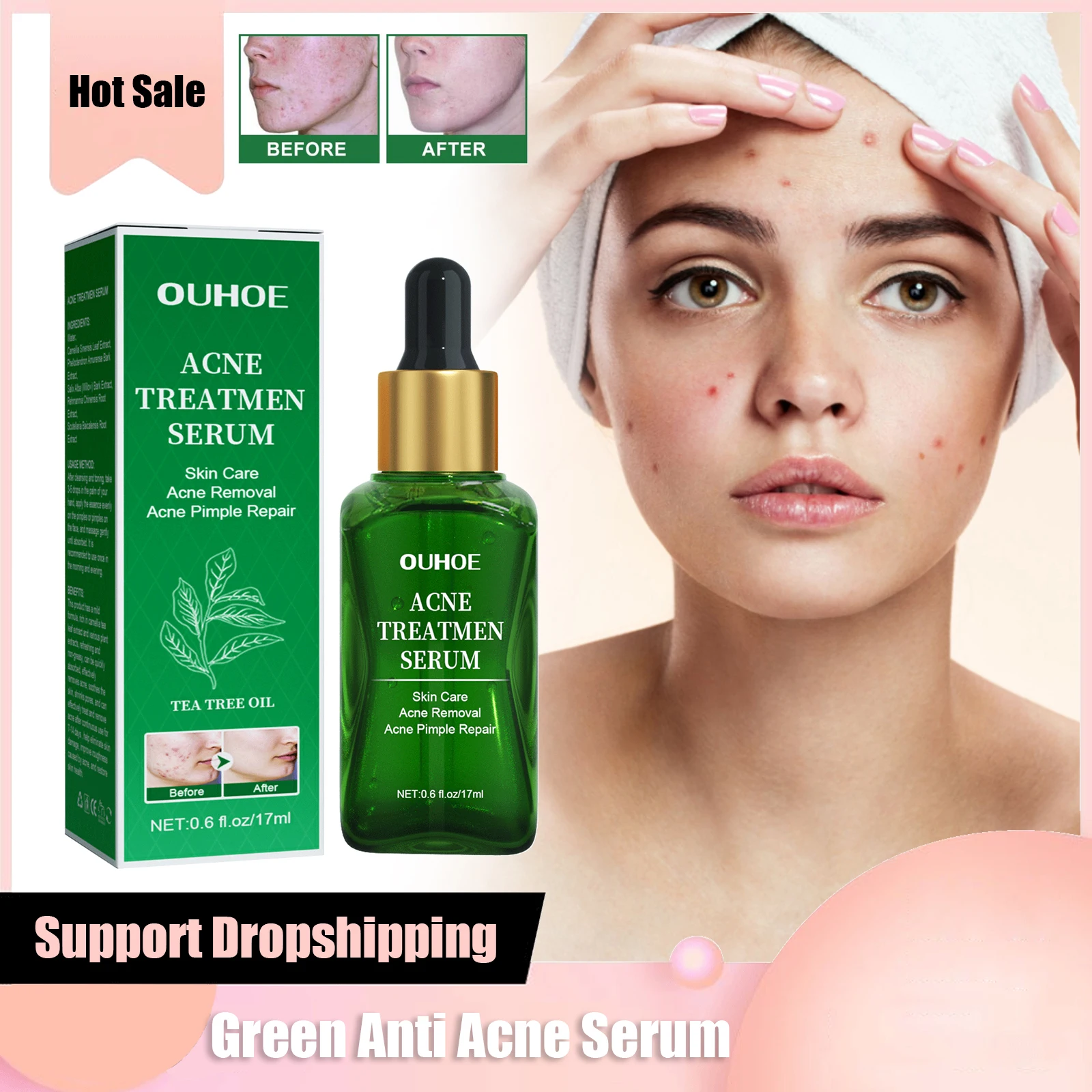 

Acne Removal Serum Shrink Pores Tighten Skin Removal Acne Spots Moisturizing Whitening Acne Solution Repair Serum Skin Care 17ml