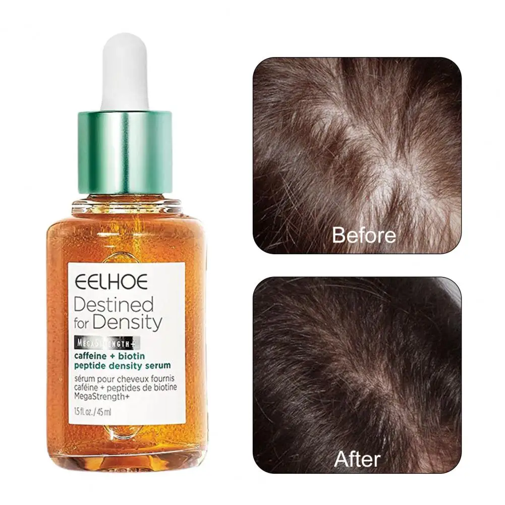 45ml Hair Follicle Repair Essence Revitalize Hair Promote Growth Healthy Safe Essence Unisex Accessories