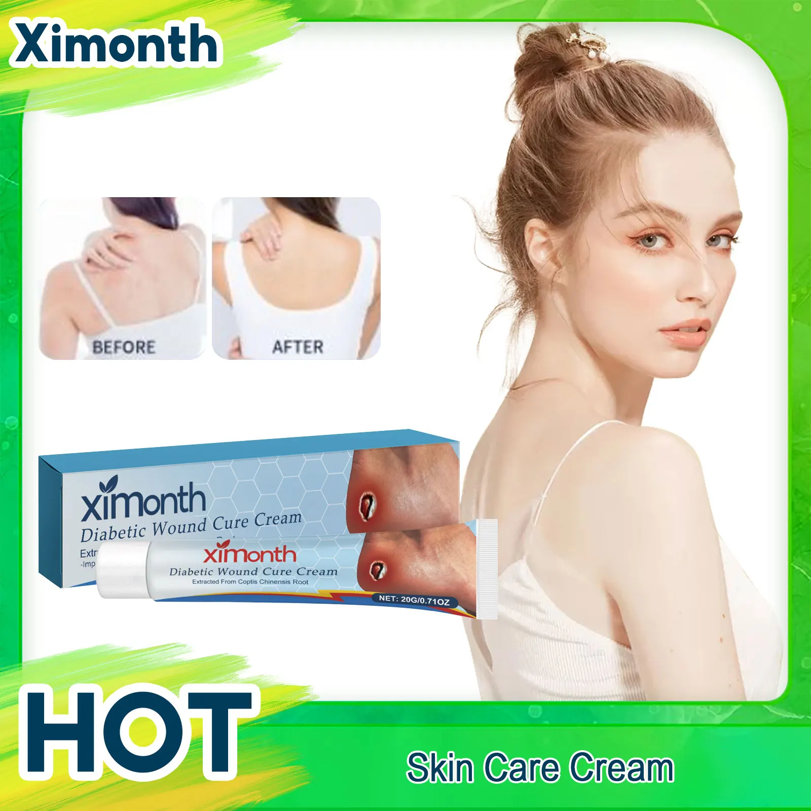Bedsores Treatment Cream Removal Rot Myogenic Pressure Sores Ulcer Festering Wound Healing Anti Infection Necrotic Skin Ointment