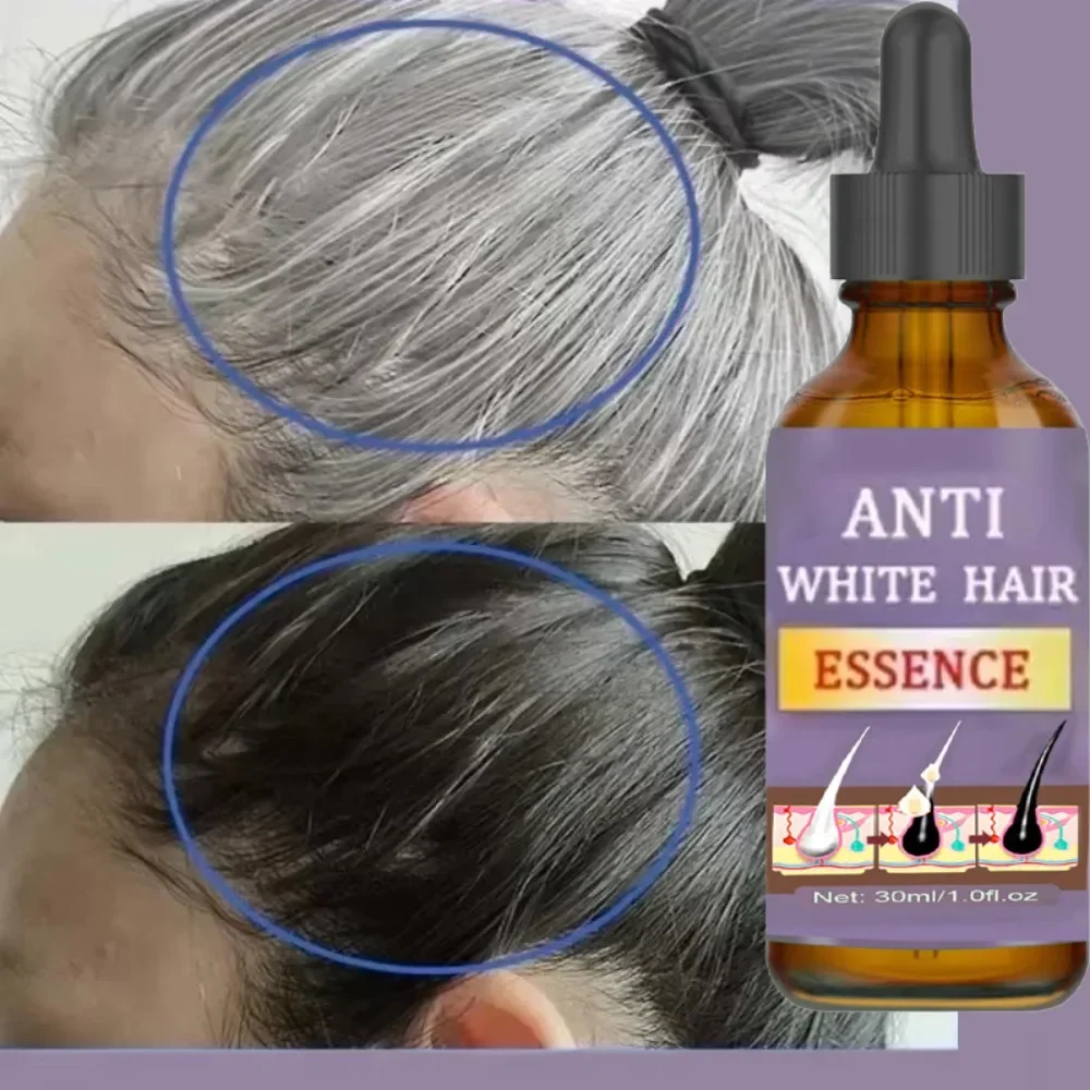 Repairs natural color remove gray hair and restore natural hair color in 7 days hair treatment