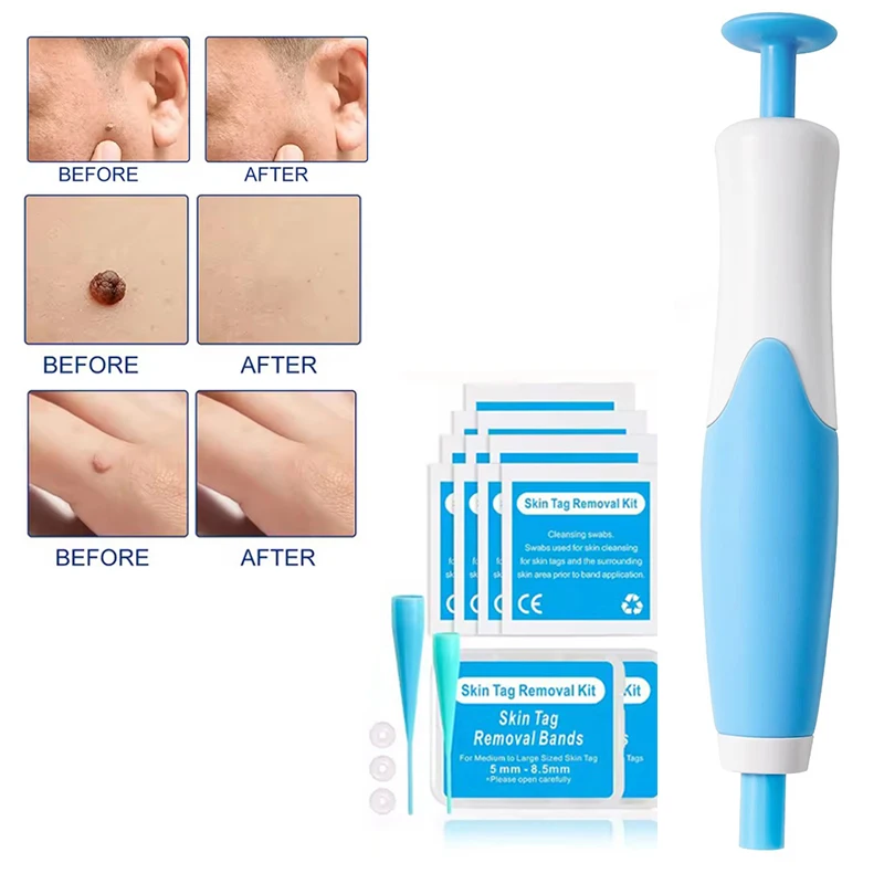 Dual Head Wart Removing Pen Set Auto Skin Tag Remover Painless Mole Wart Skin Tag Removal Kit Skin Care Beauty Tool Hot Sale
