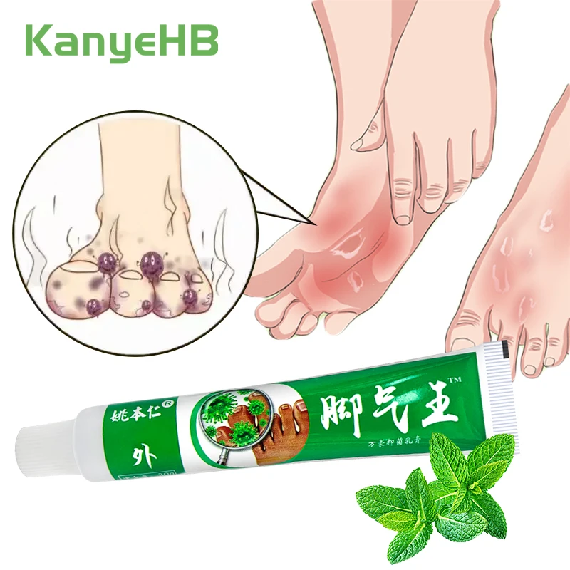 1pcs Anti Fungal Infections Beriberi Cream For Athlete's Foot Tinea