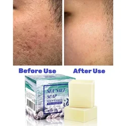 Premium Natural Sea Salt Soap with Goat Milk Gentle, Exfoliating Acne Deeply Clean Problem Skin, Body/Face/Hand Wash Skincare