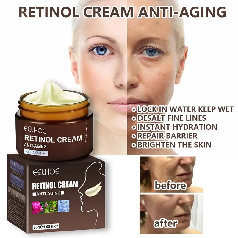 Crema facial con retinol, antiarrugas, cuidado de la piel, antiedad, reafirmante, cosmética, ácido hialurónico, hidratante y blanqueadora._voghion.com