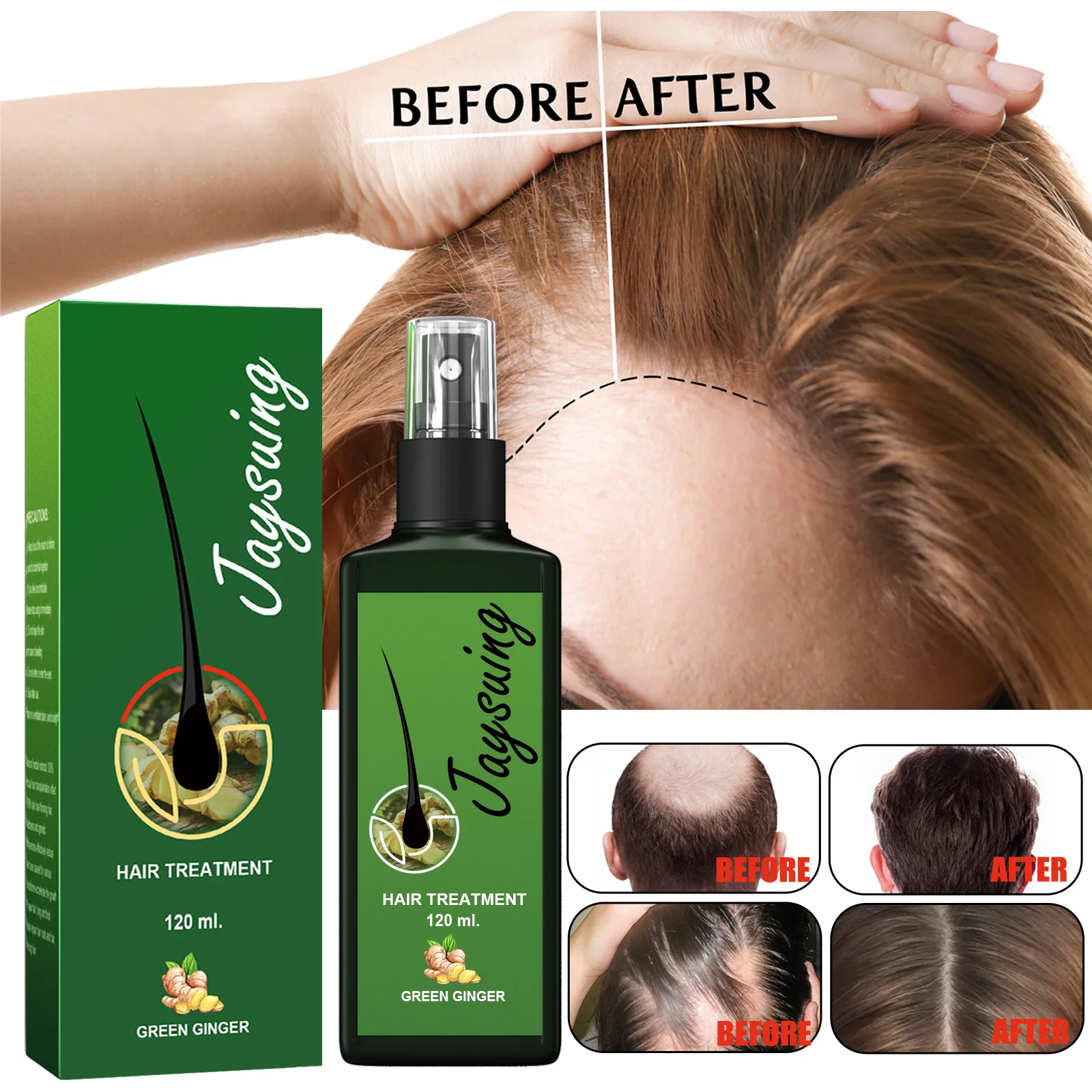 Neo Hair lotion 120ml Hair Growth Serum Essence Oil Hair Loss 100