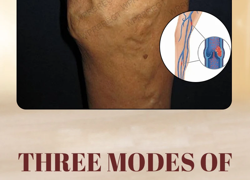Pulse Massage Patch Eliminates Varicose Veins And Effectively Improves Blood Circulation_voghion.com