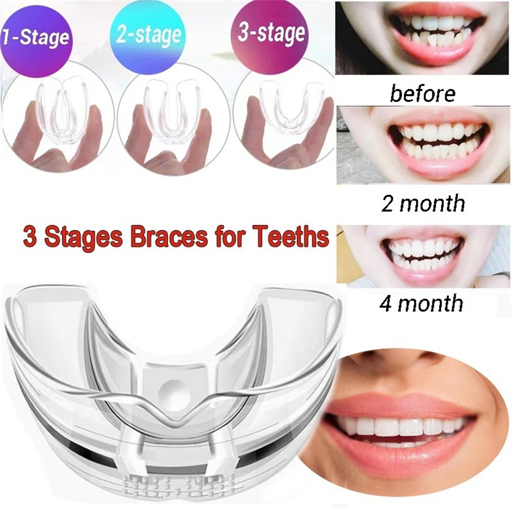 

Three Stages Silicone Tooth Invisible Orthodontic Set Dental Appliance Teeth Retainer Mouth Guard Braces виниры для зубов