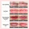 Fast Lightening Pink Mouth Lips Serum Bleaching Permanent Remove Dark Smoke Lips Lip Balm Moisturize Gloss Lipstick Lip Oil