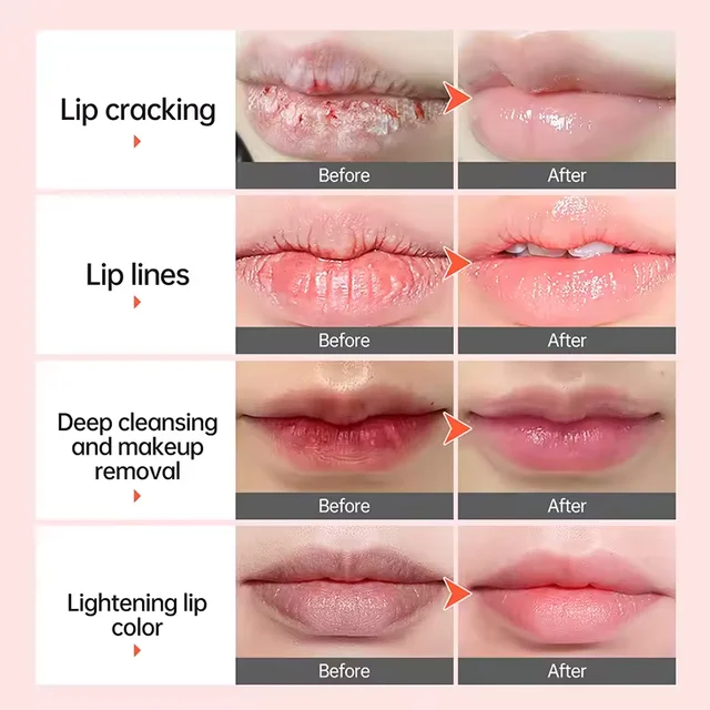 Fast Lightening Pink Mouth Lips Serum Bleaching Permanent Remove Dark Smoke Lips Lip Balm Moisturize Gloss Lipstick Lip Oil