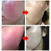 7 Day Repair Redness Serum Sooth Itching Sensitive Skin Improve Rosacea Shrink Pore Smooth Nourish Facial Skin Korean Cosmetics 2