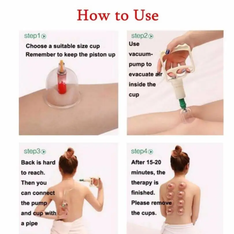 Description Picture 5 of item32 Pieces Vacuum Cupping Cup Body Massager Suction Cups Set Plastic Vacuum Cupping Pump Therapy Cans for Massage Health Care