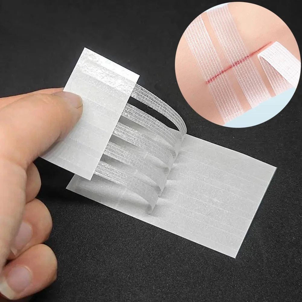 Sterile Strip First Aid Travel Wound Skin Closures Medical Bandage Strip Wound Closure Tape Adhesive First Aid Medical Adhesive