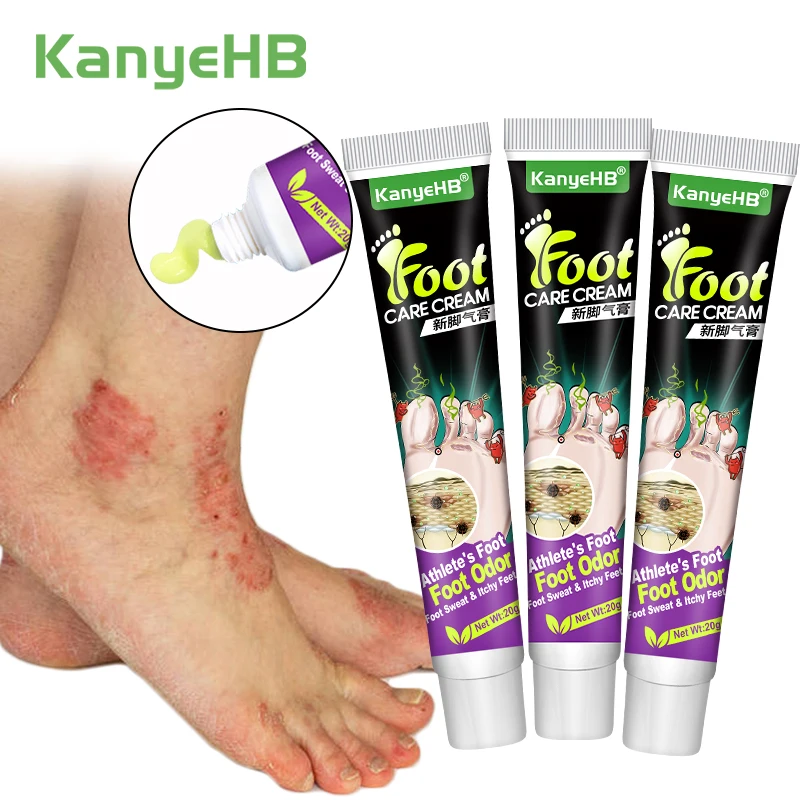 3Pcs Tinea Pedis Treatment Cream Anti-itch Inhibits Fungus Relief Foot Peeling Erosion Herb Athlete's Foot Skin Care Cream A1284 antibacterial anti fungal cream