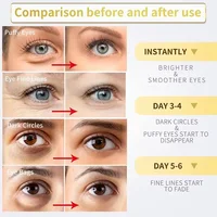 Instant Eye Bag Removal Cream Retinol Anti-Wrinkle Firming Skin Fade Fine Lines Anti Dark Circle Puffiness Brighten Eye Care 3