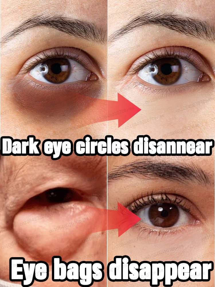Eye bags gradually disappear smile gradually opens