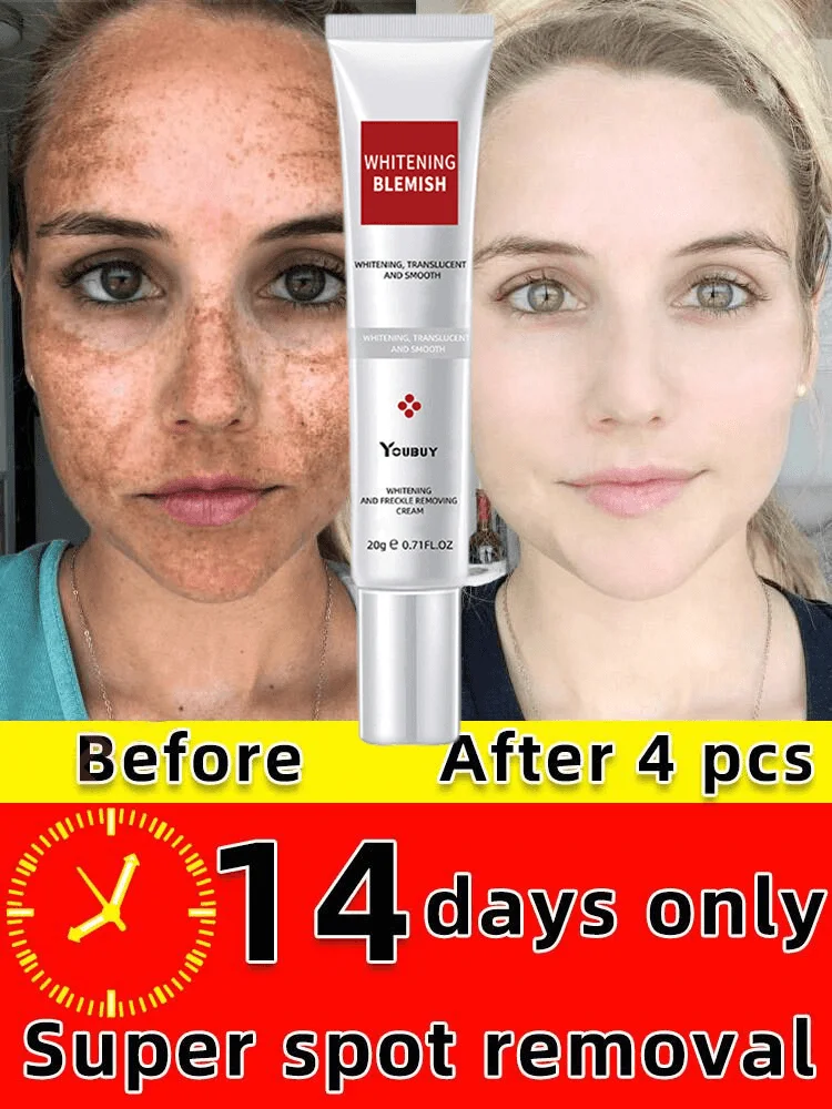 Whitening Freckle Cream Effective Remove Melasma Serum Fade Dark Spots