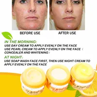 Whitening Anti-freckles Facial Cream, Dark Spot Corrector,Women Korean Face Cosmetic ,Natural Bleaching Skin Care
