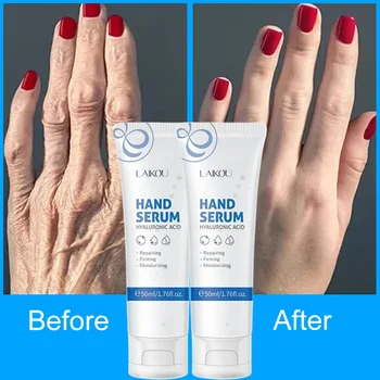 Hyaluronic Acid Anti-Wrinkle Hand Serum Cream Skin Soften Nourish Anti-Drying Whiten Moisturizing Cracked Repair Products Korean 1