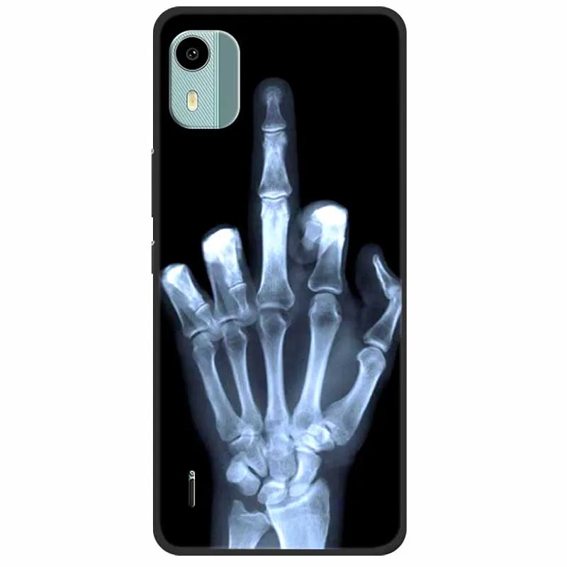 Lions Design Shockproof TPU Silicone Phone Case - Soft Protective Cover