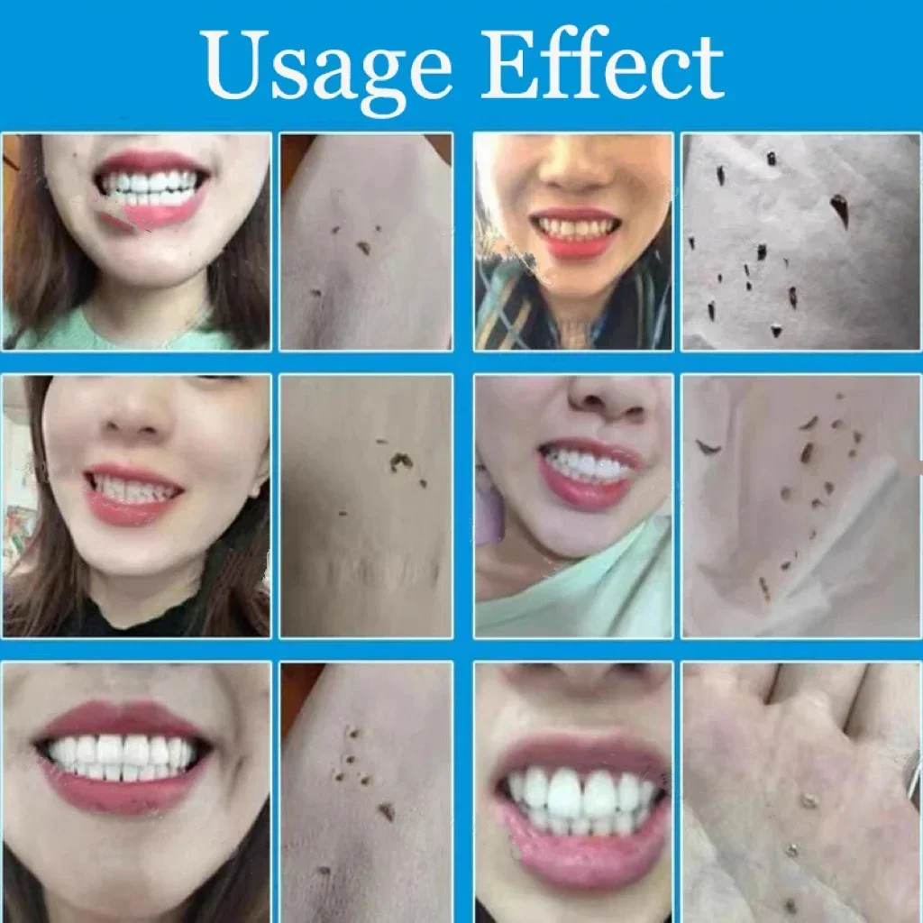 Dental Calculus Remover Teeth Whitening Spray Toothpaste Cleaning Oral Hygiene Removal Halitosis Plaque Stains Fresh Breath Care teeth whitening product,dental calculus remover,teeth health product