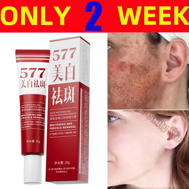 Fades Freckle Dark Spots Face Cream Niacinamide Whitening Cream Vitamin E Improve Dullness Fast Brighten Nourish Skin Care whitening body cream niacinamide serum facial cream