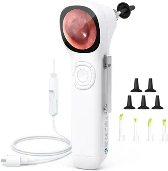 Otoscopio digitale SA160 Schermo IPS Otoscopio video intelligente HD con luce, otoscopio per orecchio con fotocamera per rimozione cerume