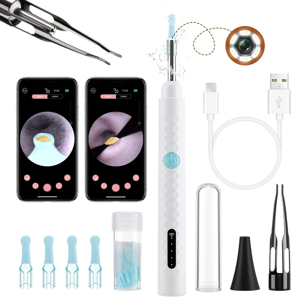Electric Visual Ear Cleaner with Tweezers 2 in 1 Ear Wax Removal Tool with Camera Rechargeable Ear Pick for Adults Kids Black