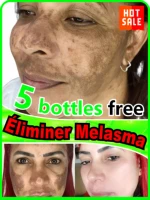 Effectively solves all pigmentation symptoms