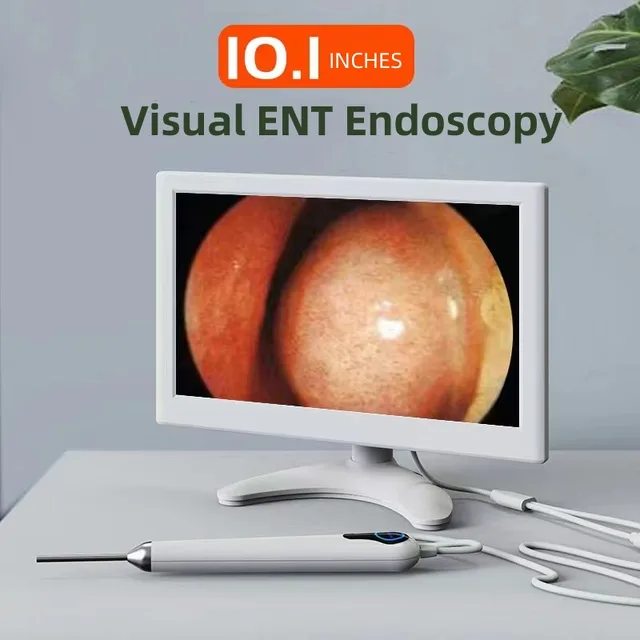 Endoscope Kanolaryngoscope visuel avec écran numérique de 10.1 pouces,  outil de nettoyage de caméra ORL, livres d'oreille Kanoscopio, utilisation  à