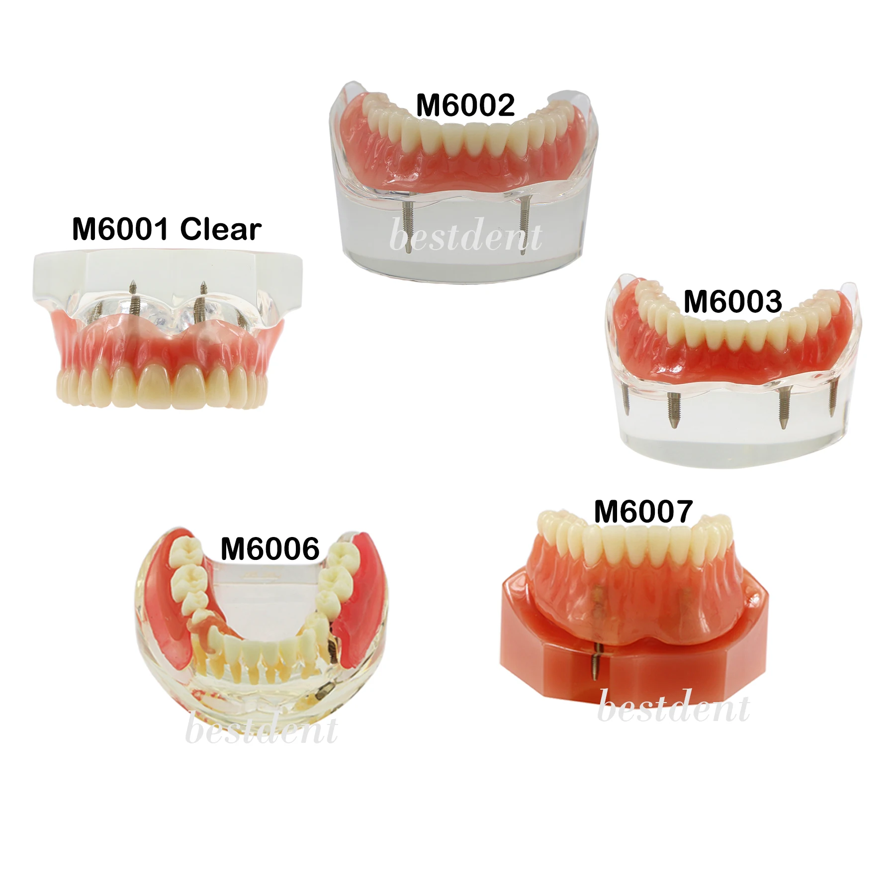 Unilateral Vs Bilateral Space Maintainer corona.dothome.co.kr