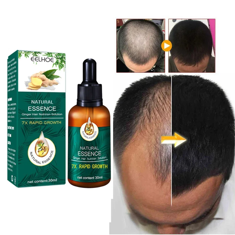 

Effective Fast Ginger Hair Growth Products Essential Hair and Scalp Treatment Oil Serum Anti-Hair Loss Repair Hair Scalp Damaged