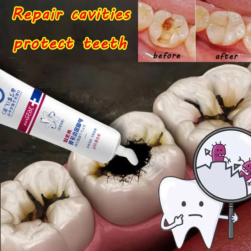 

Sdatter Toothpaste Quickly Repair Gums Decay Cavities Caries Protect Teeth Whitening Toothpaste To Remove Plaque Eliminate Bad B