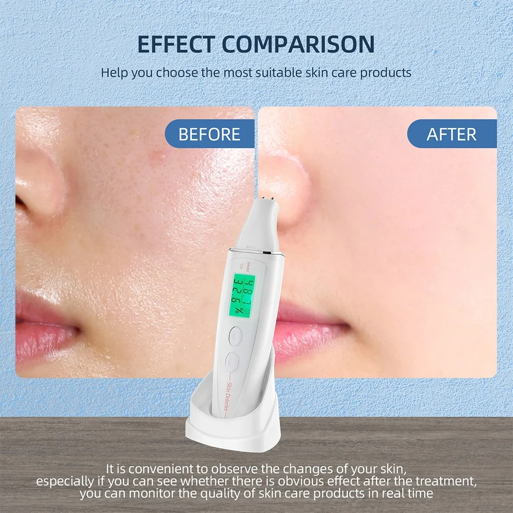 LCD Digital Skin Tester Skin Moisture&Oil Test Meter Skin Analyzer Fluorescent Agent Detector For Forehead Cheek Skin Care