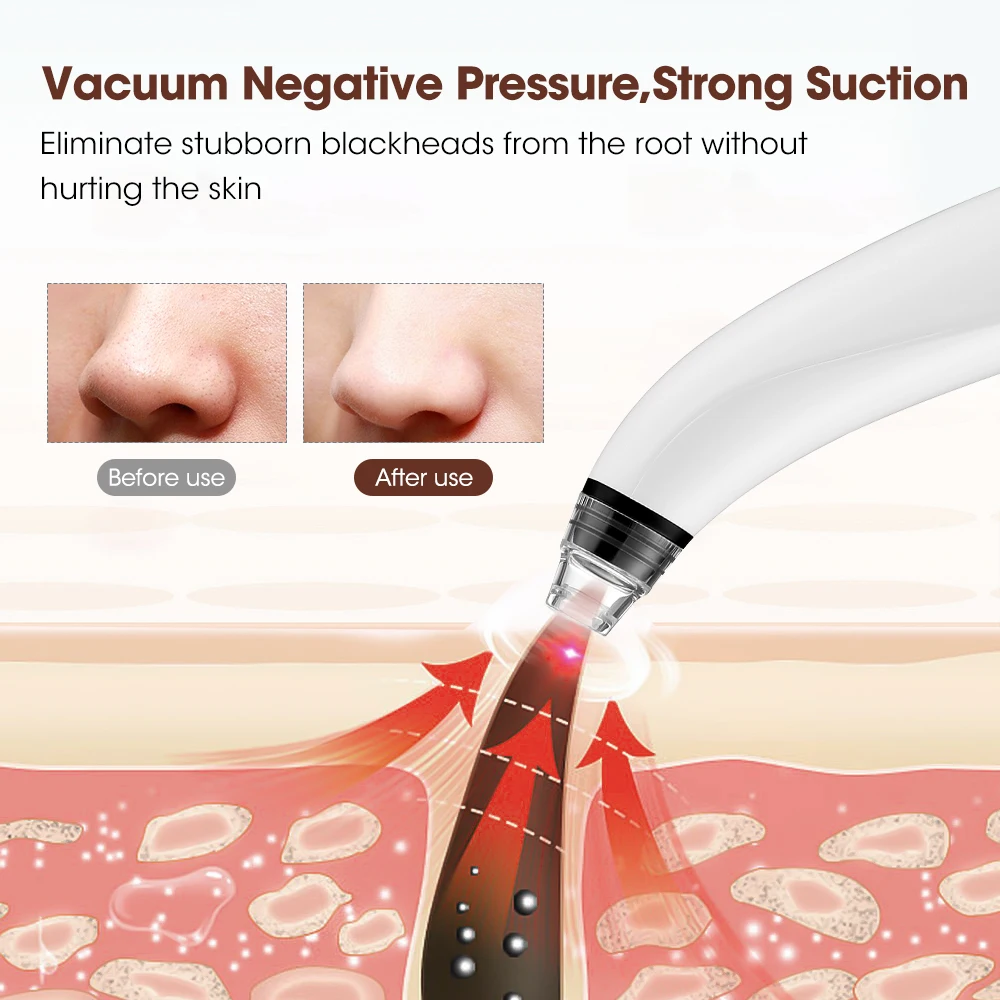 Electric Blackhead Remover with Camera Skin Care Whitehead Black Dot Extractor Acne Treatment Beauty Facial Pore Vacuum Cleaner blackhead remover
