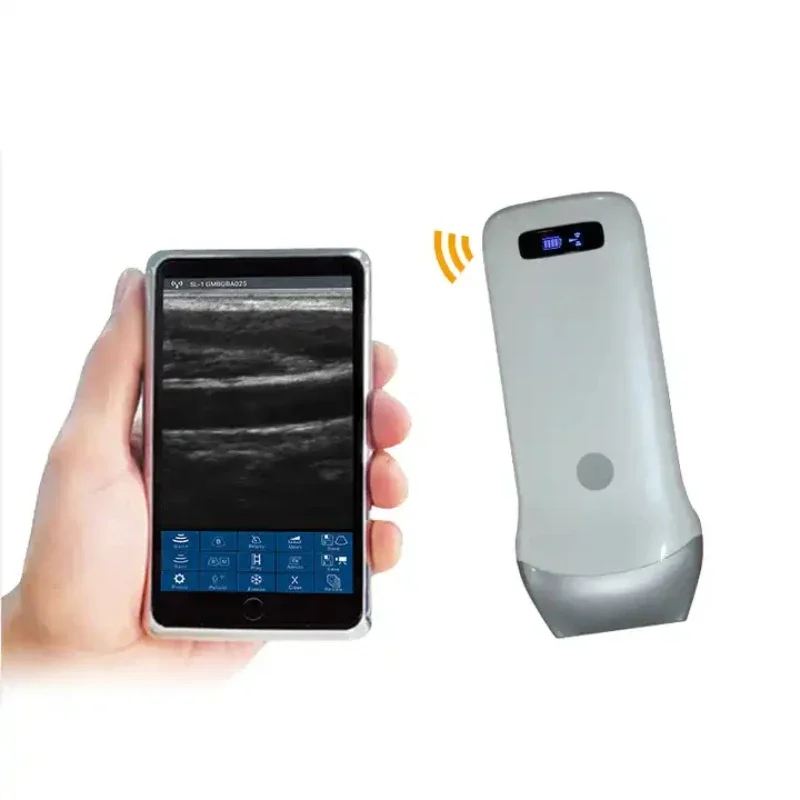 

128 Elements Portable Wireless Ultrasound Handheld Convex Linear Probe Ultrasound Scanner FMS-011 Medical Equipment