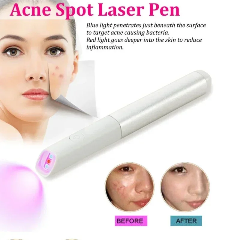 Beauty Instrument Portable Red Blue Light Therapy Face Acne Spot Treatment Pen Acne Scar Pimple Wrinkle Removal Pen