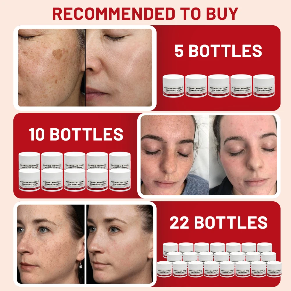 Whitening Cream 7-day rapid freckle removal