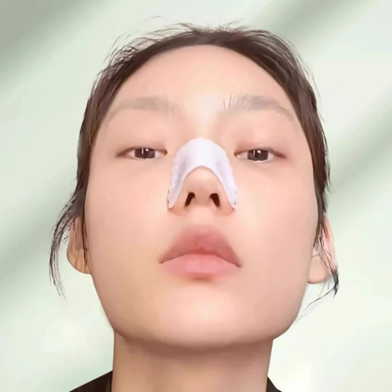 Low Temperature Thermoplastic Board Beauty Fracture Splints High Nose Bridge Reusable Health Care Brace Nasal Shaping Corrector