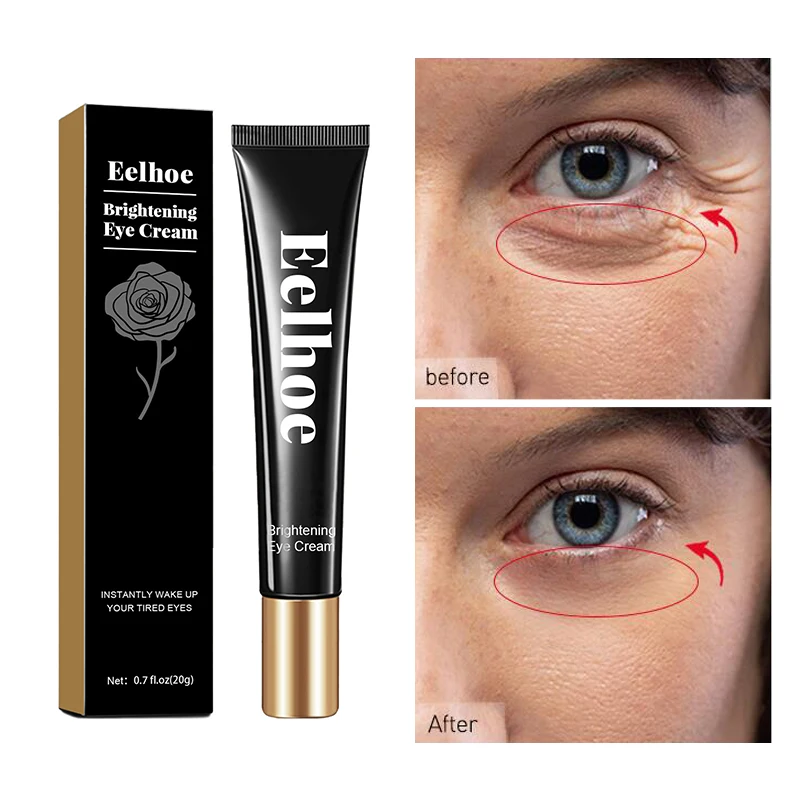 Remove Dark Circles Eye Cream Eye Bags Wrinkle Removal Serum Anti Aging