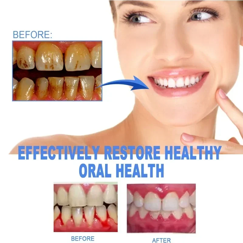 Tooth Repair Toothpaste Gel relief gum swelling pain cleaning yellow stains tartar removal odor Breath teeth Pen Oral Care teeth whitening product,teeth whitening essence,dental calculus remover,teeth health product