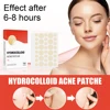 144pcs/set Face Skin Care Acne Pimple Patch 2 Sizes Invisible Professional Healing Absorbing Spot Sticker Covering for Men Women 3