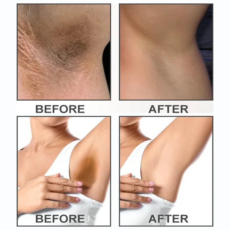 Whitening Cream For Dark Skin Armpit Thigh Inner Joint Lightening Intimate Area Underarm Body Care Private Parts Brighten Lotion whitening lotion