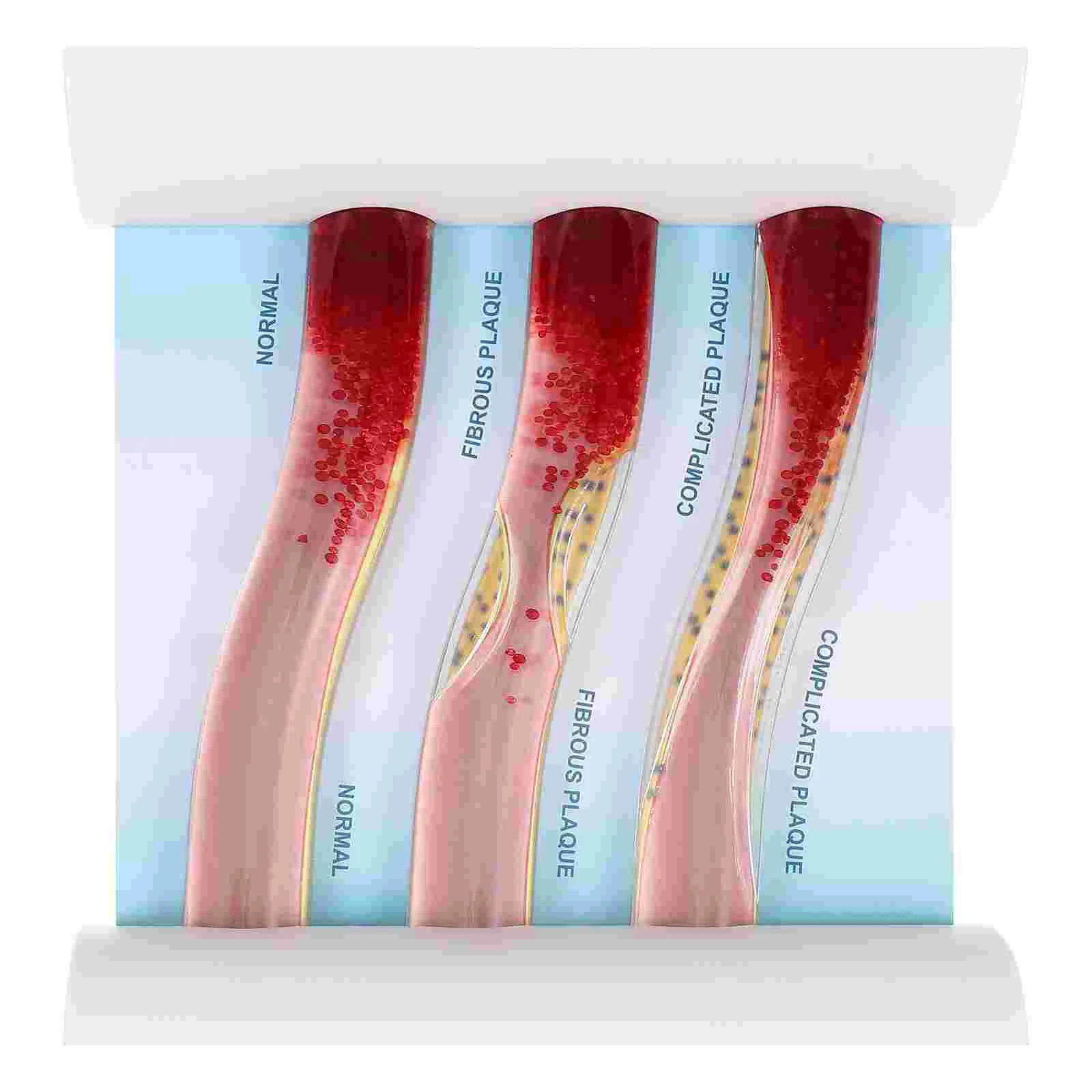 

Динамическая модель кровяного липида, сосудистая модель, модель анатомических кровеносных сосудов