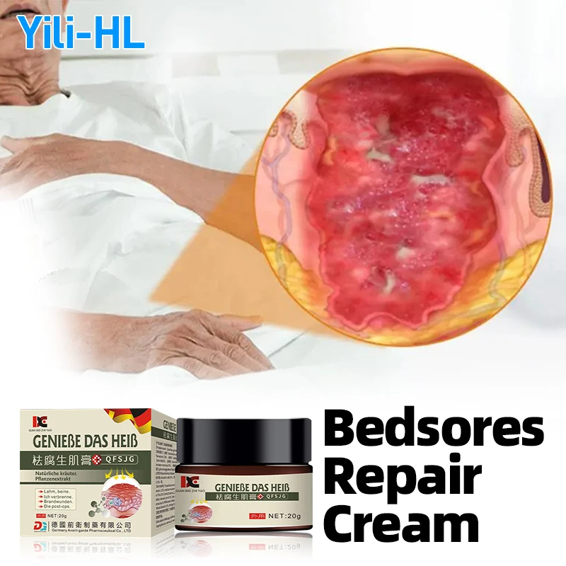 

Bedsores Treatment Cream Anti Bed Sore Wound Healing Myogenic Pressure Ulcer Decubitus Skin Care Ointment Germany Medicine