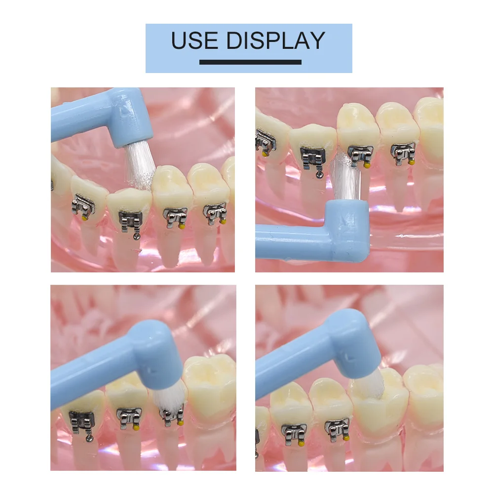 1Pcs Orthodontic Interdental Brush Small Head Soft Hair Teeth Cleaning Toothbrush Oral Care Tools Toothbrush Gap Clean