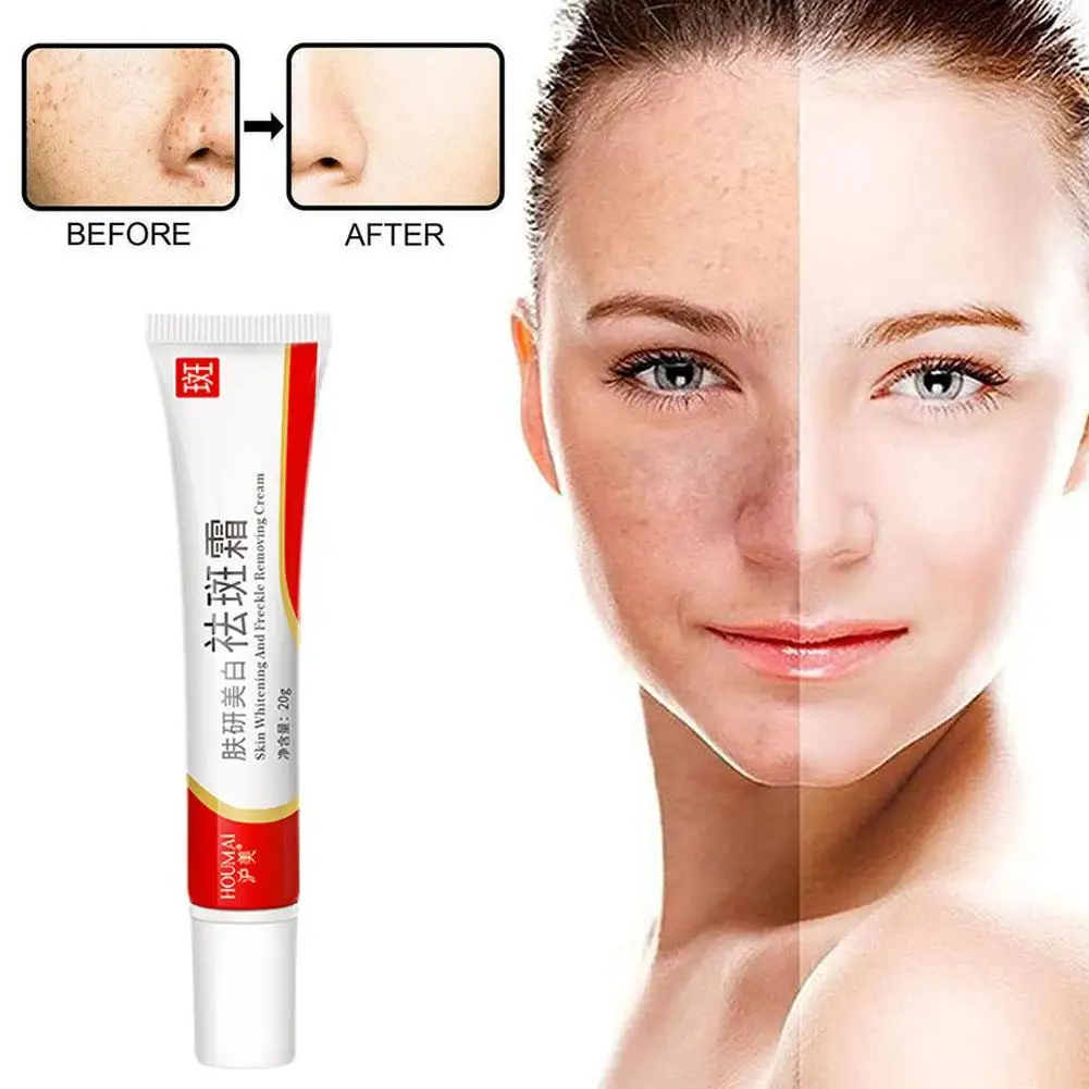 

Whitening Freckle Cream Remove Dark Spots Anti Freckle Face Creams Niacinamide Fade Pigmentation Melasma Brighten Skin Care 20g