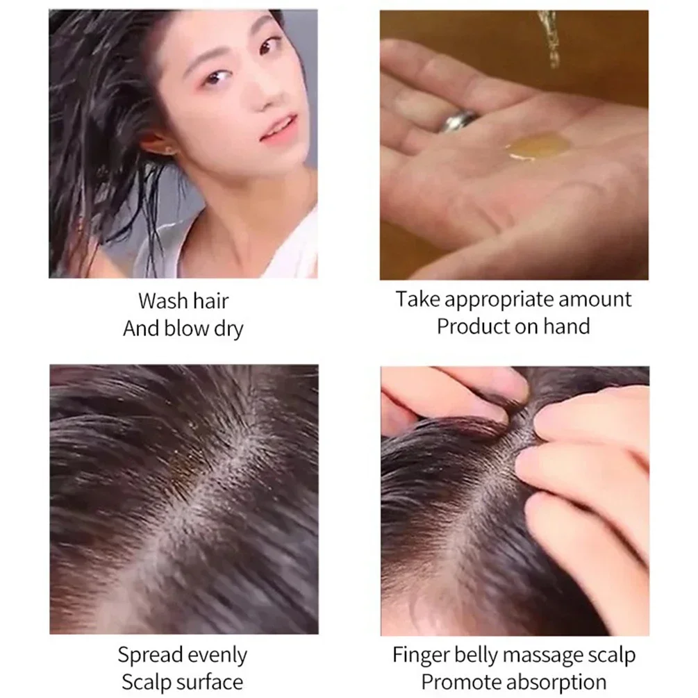 30ml Private Label Hair Growth Serum Custom Logo Hairs Root Grow Nutrient Solution Prevention Hair-loss Essential Oil Makeup 5