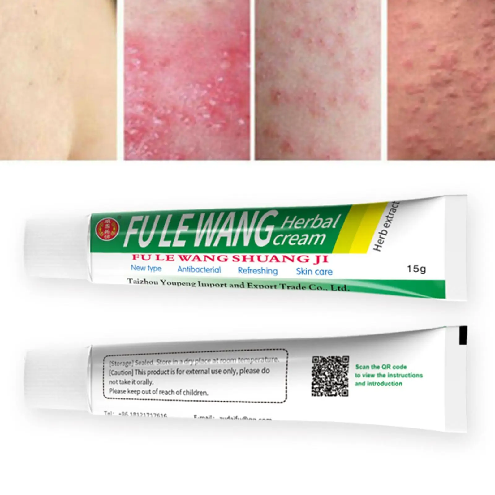 Herbal Cream Ointment Psoriasis Cream Relief Skin Itch Rash Dermatitis Eczematoid Skin Care Antibacterial 10pcs